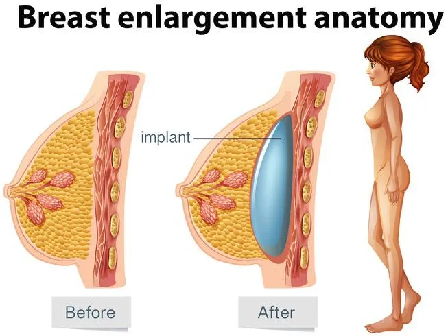 Comprehensive Guide to Modern Breast Augmentation Procedures Understanding Your Options